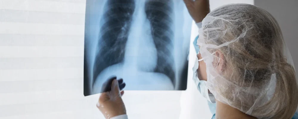 Pesquisa aponta que medicamento pode frear avanço do câncer de pulmão